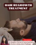 Hair regrowth Treatment