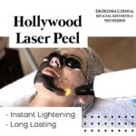 Hollywood Laser peel treatment