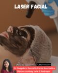 Laser Carbon facial